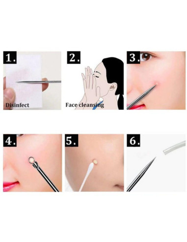 Extractor comedoane și coșuri – instrument profesional din oțel inoxidabil