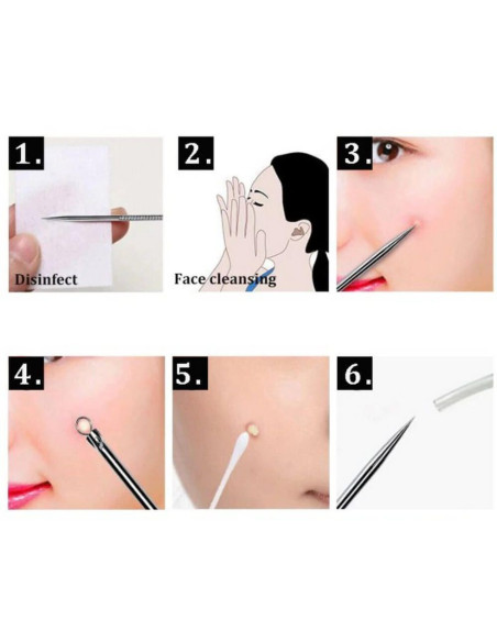 Extractor comedoane și coșuri – instrument profesional din oțel inoxidabil